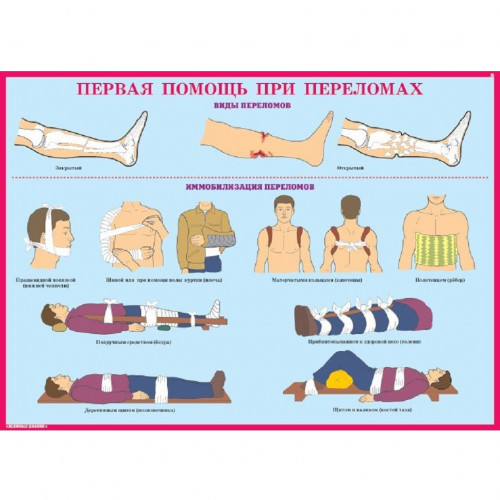 Комплект плакатов «Первая медицинская помощь в чрезвычайных ситуациях»
